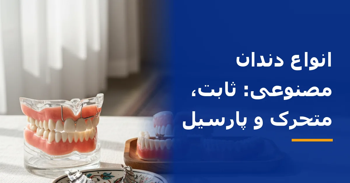 انواع دندان مصنوعی: ثابت، متحرک و پارسیل