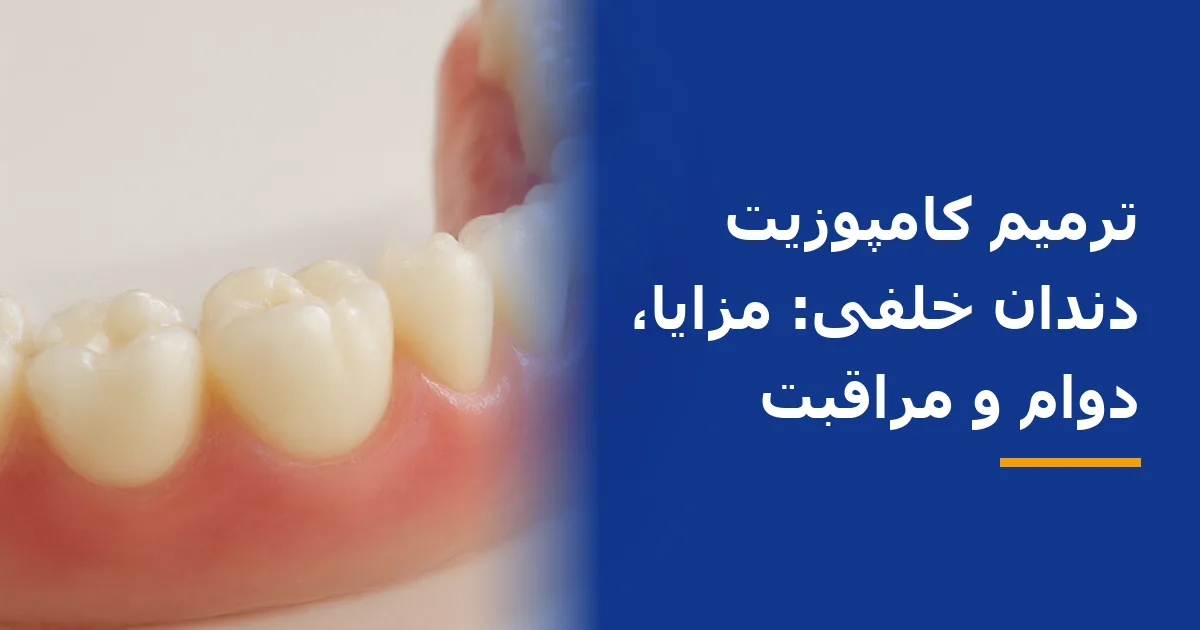 ترمیم کامپوزیت دندان خلفی: مزایا، دوام و مراقبت
