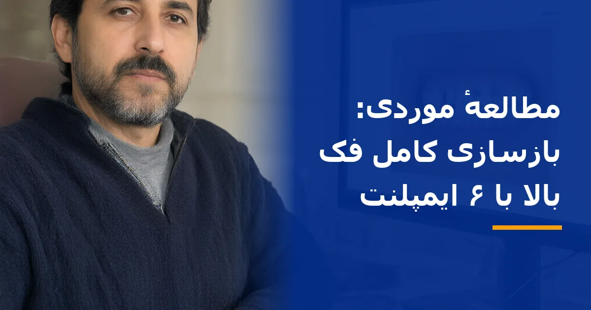 مطالعهٔ موردی: بازسازی کامل فک بالا با ۶ ایمپلنت